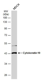 Anti-Cytokeratin 19 antibody [N1C1] used in Western Blot (WB). GTX112826