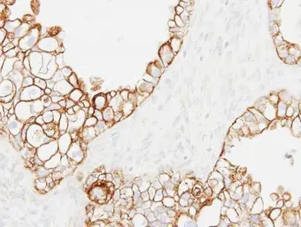 Anti-Cytokeratin 19 antibody [N1C1] used in IHC (Paraffin sections) (IHC-P). GTX112826