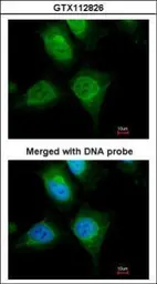 Anti-Cytokeratin 19 antibody [N1C1] used in Immunocytochemistry/ Immunofluorescence (ICC/IF). GTX112826