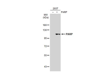 Anti-PARP antibody [N1N2], N-term used in Western Blot (WB). GTX112839