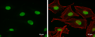 Anti-PARP antibody [N1N2], N-term used in Immunocytochemistry/ Immunofluorescence (ICC/IF). GTX112839
