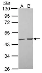 Anti-alpha Skeletal Muscle Actin antibody used in Western Blot (WB). GTX112860