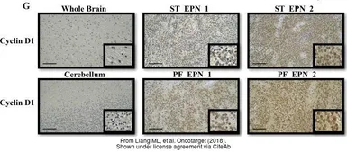 Anti-Cyclin D1 antibody [N2C3] used in IHC (Frozen sections) (IHC-Fr). GTX112874
