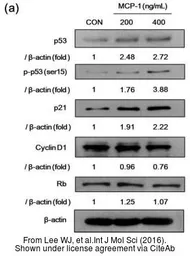 Anti-Cyclin D1 antibody [N2C3] used in Western Blot (WB). GTX112874