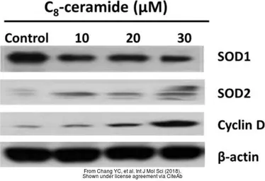 Anti-Cyclin D1 antibody [N2C3] used in Western Blot (WB). GTX112874