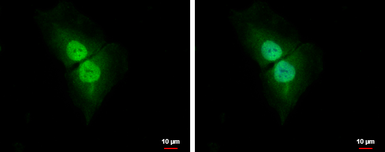 Anti-Cyclin D1 antibody [N2C3] used in Immunocytochemistry/ Immunofluorescence (ICC/IF). GTX112874