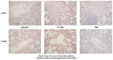 Anti-CD44 antibody [N1N2], N-term used in IHC (Paraffin sections) (IHC-P). GTX112893
