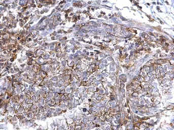 Anti-CD44 antibody [N1N2], N-term used in IHC (Paraffin sections) (IHC-P). GTX112893