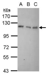Anti-Daxx antibody [N1N3] used in Western Blot (WB). GTX112908
