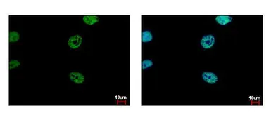 Anti-FLI1 antibody used in Immunocytochemistry/ Immunofluorescence (ICC/IF). GTX112937