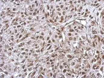 Anti-FLI1 antibody used in IHC (Paraffin sections) (IHC-P). GTX112937