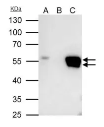 Anti-FLI1 antibody used in Immunoprecipitation (IP). GTX112937