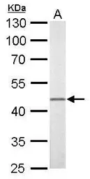 Anti-FLI1 antibody used in Western Blot (WB). GTX112937