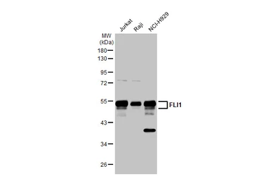 Anti-FLI1 antibody used in Western Blot (WB). GTX112937