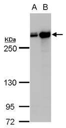 Anti-Filamin A antibody [C2], C-term used in Western Blot (WB). GTX112939