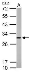 Anti-HMGB1 antibody used in Western Blot (WB). GTX112959