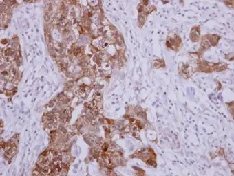 Anti-Hsp70 antibody used in IHC (Paraffin sections) (IHC-P). GTX112963