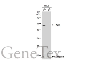 Anti-Cytokeratin 8 antibody [N1C1] used in Western Blot (WB). GTX112975