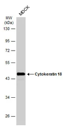Anti-Cytokeratin 18 antibody [N3C3] used in Western Blot (WB). GTX112978