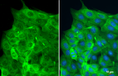 Anti-Cytokeratin 18 antibody [N3C3] used in Immunocytochemistry/ Immunofluorescence (ICC/IF). GTX112978