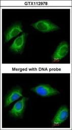 Anti-Cytokeratin 18 antibody [N3C3] used in Immunocytochemistry/ Immunofluorescence (ICC/IF). GTX112978