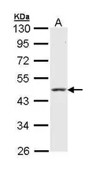 Anti-Cytokeratin 18 antibody [N3C3] used in Western Blot (WB). GTX112978