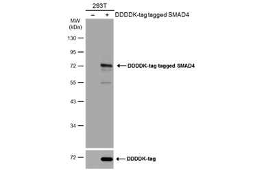 Anti-SMAD4 antibody used in Western Blot (WB). GTX112980