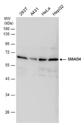 Anti-SMAD4 antibody used in Western Blot (WB). GTX112980