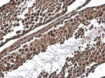 Anti-SMAD4 antibody used in IHC (Paraffin sections) (IHC-P). GTX112980