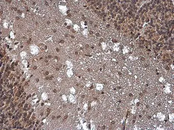Anti-SMAD4 antibody used in IHC (Paraffin sections) (IHC-P). GTX112980