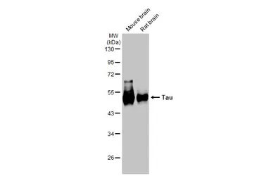 Anti-Tau antibody used in Western Blot (WB). GTX112981