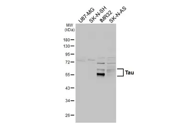 Anti-Tau antibody used in Western Blot (WB). GTX112981