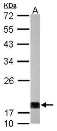Anti-nm23-H1 antibody [N1C3] used in Western Blot (WB). GTX112988