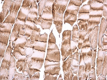 Anti-PI3 kinase p85 alpha antibody used in IHC (Paraffin sections) (IHC-P). GTX112994