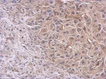 Anti-PI3 kinase p85 alpha antibody [C2C3], C-term used in IHC (Paraffin sections) (IHC-P). GTX112995