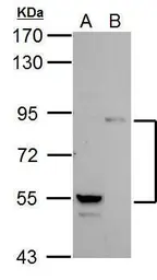 Anti-PI3 kinase p85 alpha antibody [C2C3], C-term used in Western Blot (WB). GTX112995