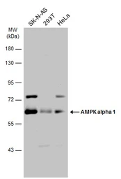 Anti-AMPK alpha 1 antibody used in Western Blot (WB). GTX112999