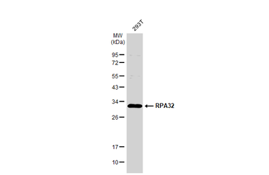 Anti-RPA32 antibody used in Western Blot (WB). GTX113004