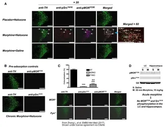 Anti-Tyrosine Hydroxylase antibody used in IHC (Frozen sections) (IHC-Fr). GTX113016