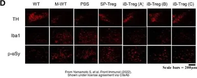 Anti-Tyrosine Hydroxylase antibody used in IHC (Frozen sections) (IHC-Fr). GTX113016