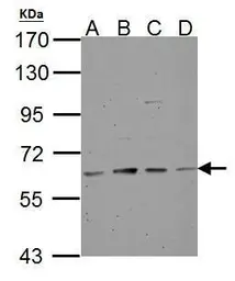 Anti-Tyrosine Hydroxylase antibody used in Western Blot (WB). GTX113016