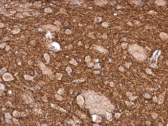 Anti-Tyrosine Hydroxylase antibody used in IHC (Paraffin sections) (IHC-P). GTX113016