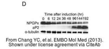 Anti-alpha Tubulin antibody [DM1A] used in Western Blot (WB). GTX11302