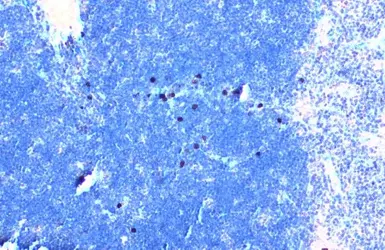 Anti-TLR3 antibody used in IHC (Paraffin sections) (IHC-P). GTX113022