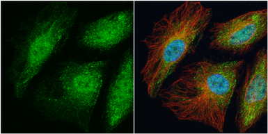 Anti-TRAF6 antibody [N2C2], Internal used in Immunocytochemistry/ Immunofluorescence (ICC/IF). GTX113029