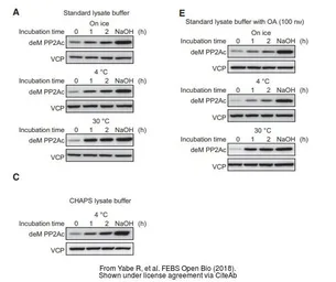 Anti-VCP antibody [N1N2], N-term used in Western Blot (WB). GTX113030