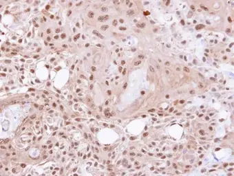 Anti-VCP antibody [N1N2], N-term used in IHC (Paraffin sections) (IHC-P). GTX113030