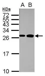 Anti-Fast skeletal myosin light chain 1 antibody used in Western Blot (WB). GTX113092