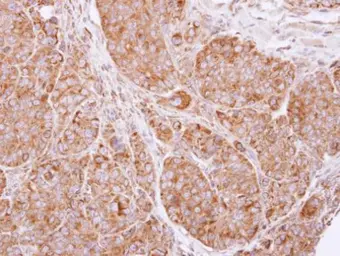Anti-cIAP2 antibody [C1C3] used in IHC (Paraffin sections) (IHC-P). GTX113128