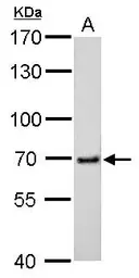 Anti-cIAP2 antibody [C1C3] used in Western Blot (WB). GTX113128